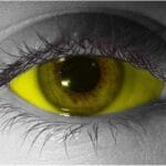 Yellow Sclera Contact Lenses 22mm - Gothika Custom - Pair