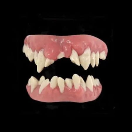 Monster Teeth - Custom Fit Veneers