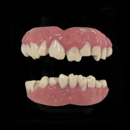 Zombie Teeth - Custom Fit Veneers